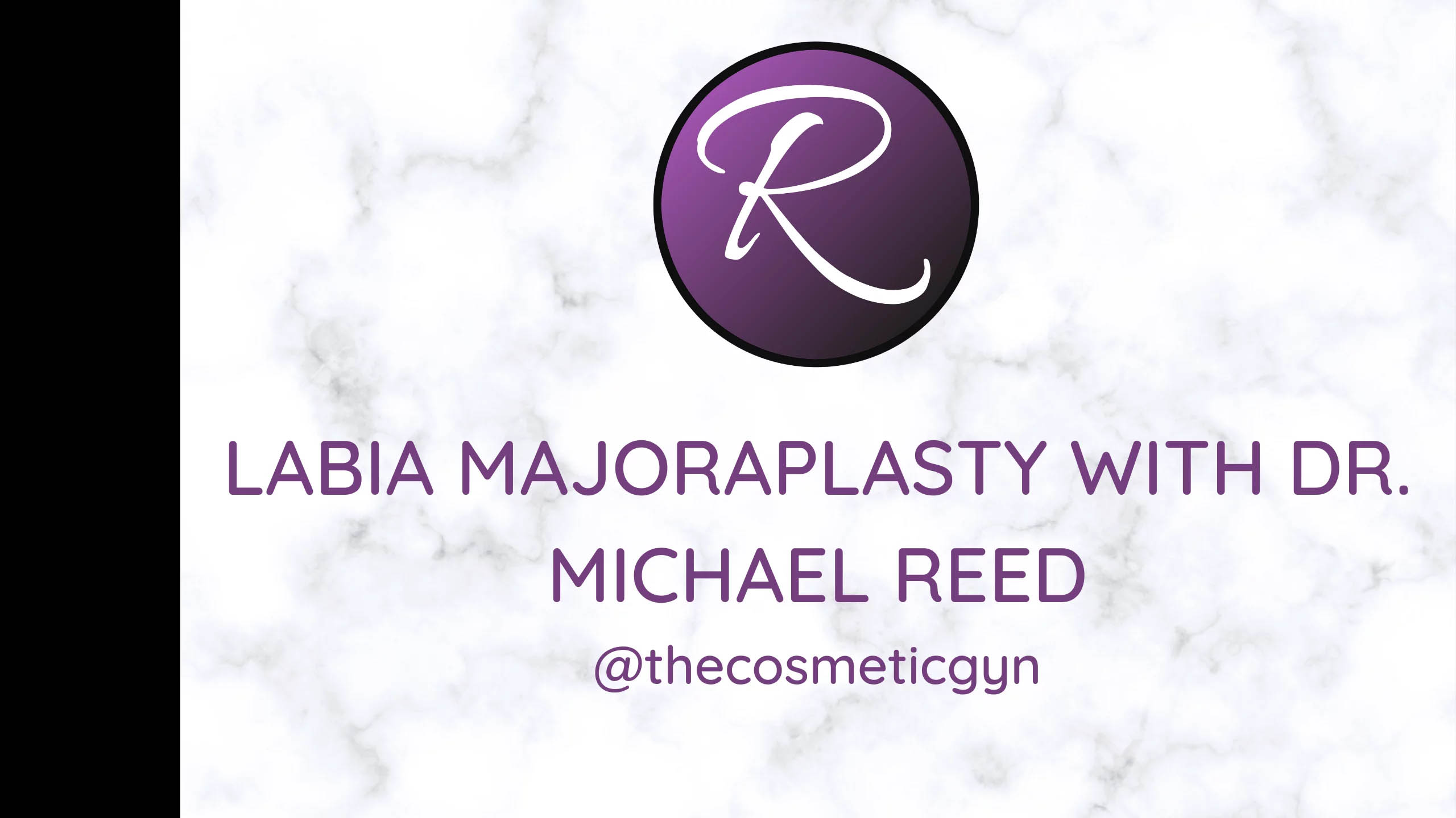 Labia Majoraplasty with Dr. Michael Reed